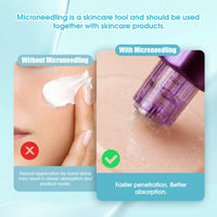 Mast Microneedle Cartridge Needles Sample Mixed Size– Box of 4