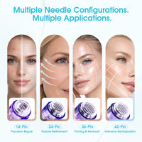 Mast Microneedle Cartridge Needles Sample Mixed Size– Box of 4