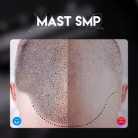 Mast SMP Scalp Micropigmentation Set - Dragonhawktattoos